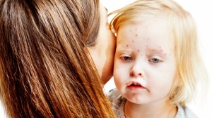 Risc de epidemie de rujeola in Romania