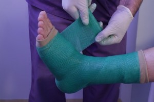 Stiati ca exista "ghipsuri de Craciun"