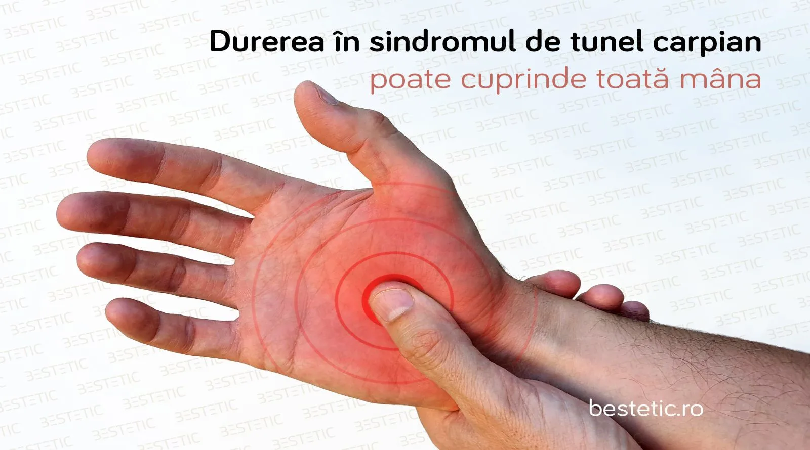 1 Durere in mana 2 Sindromul de tunel carpian nou