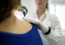 Primul centru multidisciplinar integrat pentru tratarea melanomului